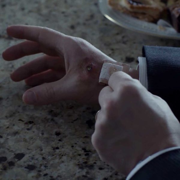 The Rooster Prince (2014) Fargo: 01×02 – Adam Bernstein